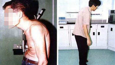 强直挡不住他前进的路 强直挡不住他前进的路